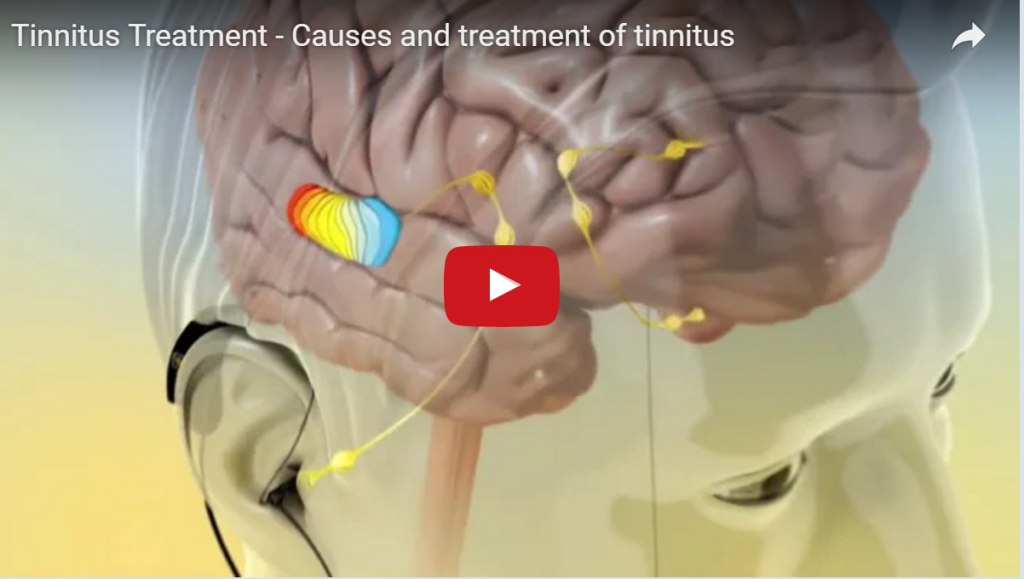 That Ringing In Your Ears Could Be Tinnitus 6 Tinnitus treatment and causes