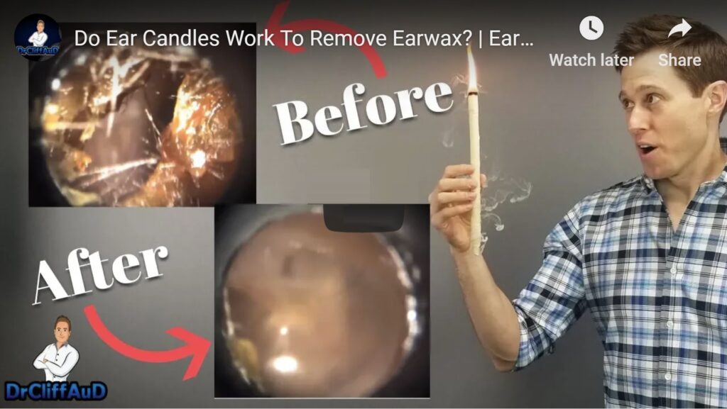 Do Ear Candles Remove Ear Wax? 4 Do Ear Candles Remove Ear Wax